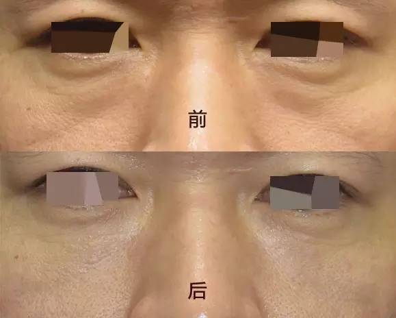 sɌO | ĘǂPQ߀۴Լ]cx(sh)