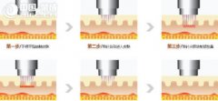 ʲôSl΢##